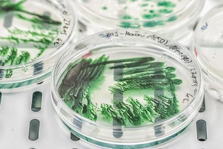 Low-Res_PM_ND85163©André Künzelmann UFZ