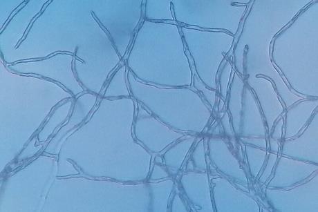 Fungal_hyphae_and_mycelium