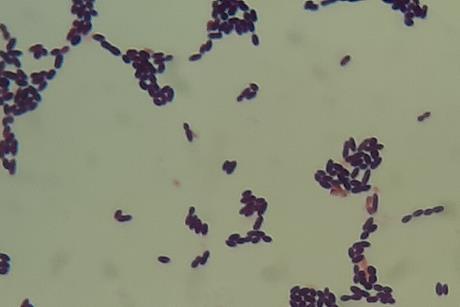 Enterococcus_faecium_in_Gram_Staining_of_culture