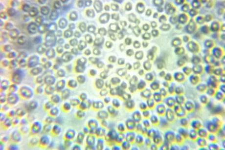 Microscope_view_of_Candida_albicans_34