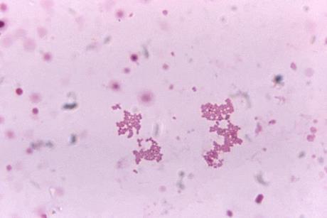 Veillonella_spp._under_1125X_magnification