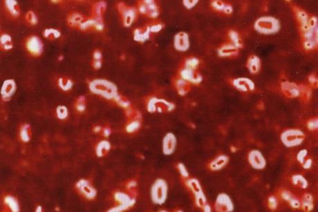 Капсула_Klebsiella_Pneumoniae