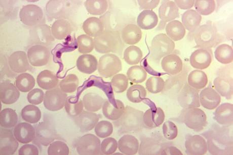 T._cruzi_trypomastigotes_in_peripheral_blood_smear
