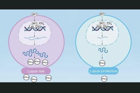 lupus