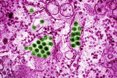 Dengue_Virus_Particles_(53231916461)