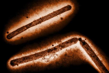 Influenza_A_H5N1_Virus_Particles