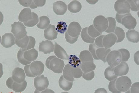 P._vivax_-_schizonts
