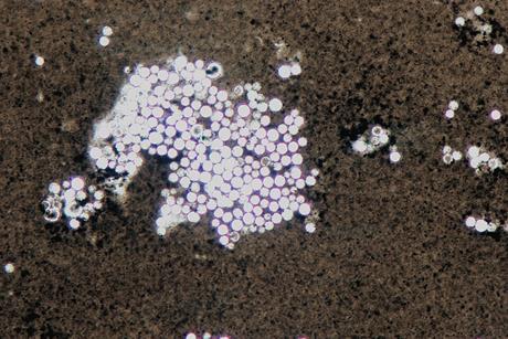 Cryptococcus_neoformans