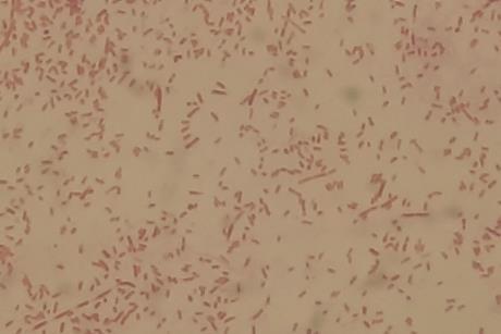 Gram_Negative_Rods_of_Aeromonas_hydrophila