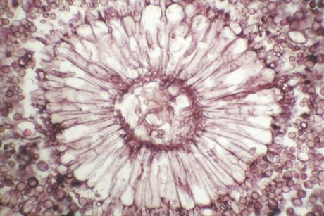 Aspergillus_-_Conidial_head_(5414785274)