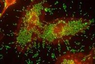 Low-Res_Two distinct patterns of attachment to human cells