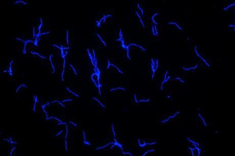 Low-Res_Borrelia_recurrentis_c_Flavia_Reyer_unimedizin-ffm
