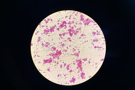 Nontuberculous_Mycobacteria_(NTM)_in_Ziehl-Neelsen_Staining_from_Positive_MGIT_Culture