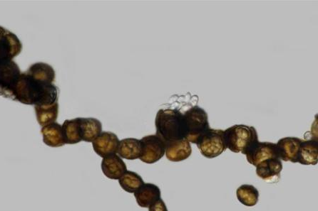 Low-Res_melanized hyphae developing into chlamydospores(1)