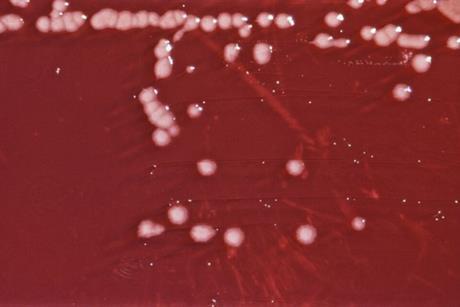 Pseudomonas_aeruginosa_01