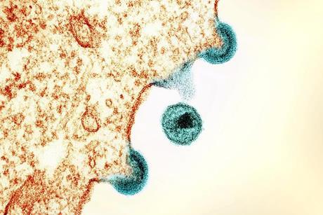 Low-Res_HIV TEM_update