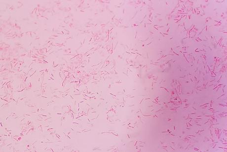 Capnocytophaga_canimorsus_gram_stain
