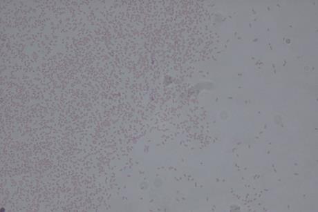 960px-Pantoea_agglomerans