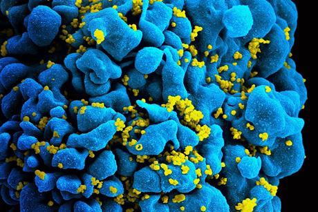 HIV-infected_T_cell_(6813384933)