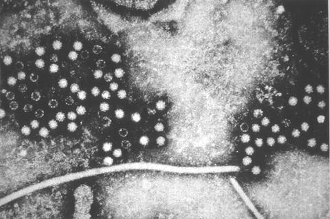 Hepatitis E virus