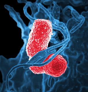 Multidrug-resistant_Klebsiella_pneumoniaeand_neutrophil