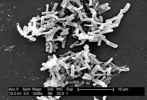 1024px-Clostridium_difficile_01