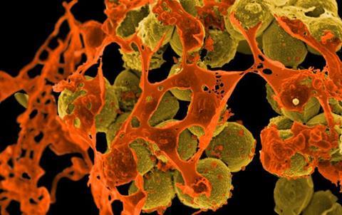 Methicillin-resistant_Staphylococcus_aureus_(MRSA)_Bacteria