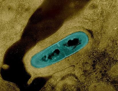 1024px-Listeria_Bacterium_03