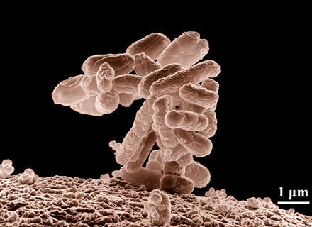 E. coli at 10,000x