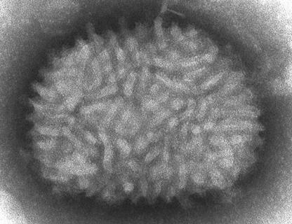 Vaccinia virus
