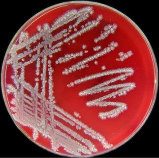 Bacillus licheniformis