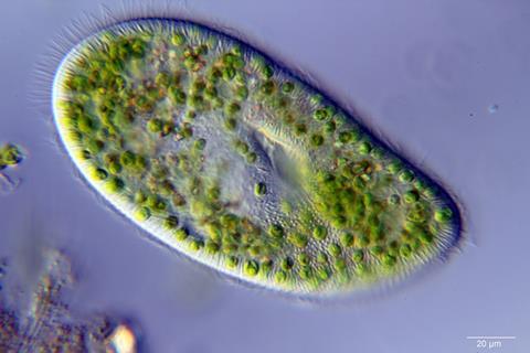 3240px-Paramecium_bursaria