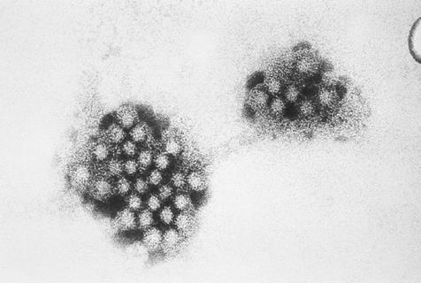 Norovirus_EM_PHIL_2172_lores