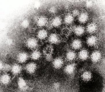 Norovirus_4