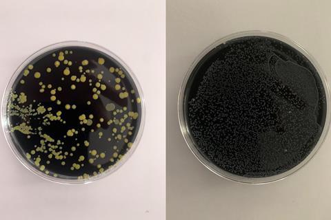 Legionella overgrowth