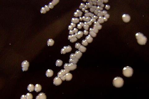 Bordetella_pertussis_on_Charcoal_Agar_supplemented_with_Cephalexin_-_Detail