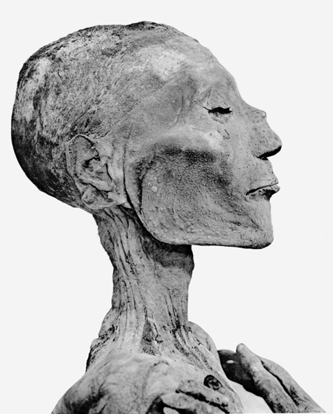 867px-Ramses_V_mummy_head