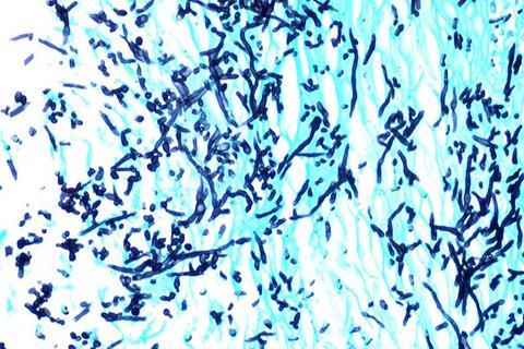 Candidiasis (1)