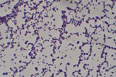 Staphylococcus_aureus_Gram_stain (2)