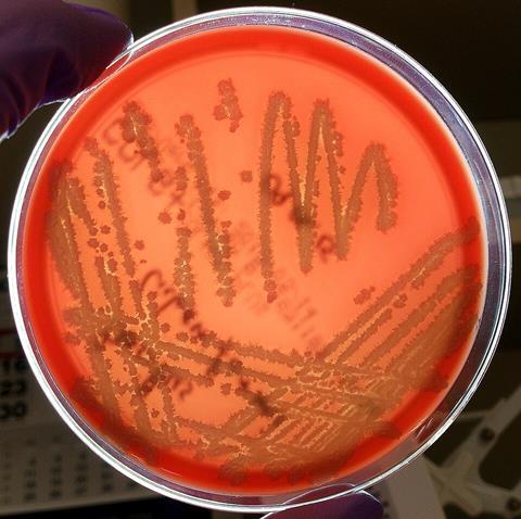 Bacillus_licheniformis_02