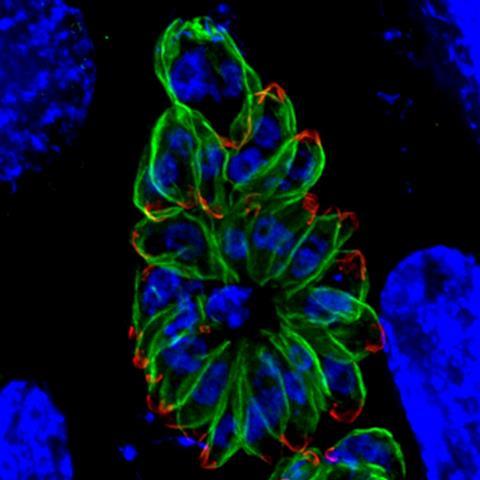 Humans_fibroblasts_infected_with_a_mutant_of_the_intracellular_parasite_Toxoplasma_gondii_-_image.pbio.v10.i12.g001