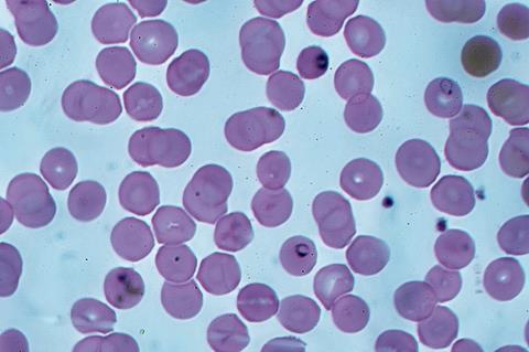 Malaria_falciparum_ring_forms