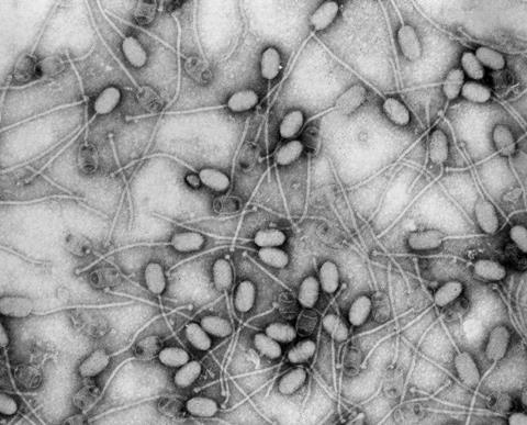 Phage_de_S_aureus_3A