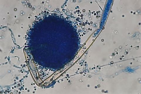 Aspergillus_niger_in_LPCB_Tease_Mount_at_1600X