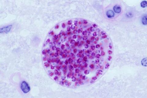 Toxoplasma_gondii_tissue_cyst_in_mouse_brain
