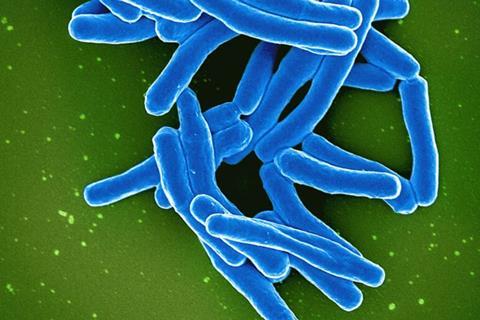 Mycobacterium_Tuberculosis_Bacteria,_the_Cause_of_TB_(52766648935)