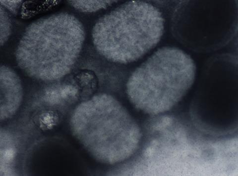 Molluscum_contagiousum_virus_(negative_staining)