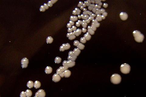 Bordetella_pertussis_on_Charcoal_Agar_supplemented_with_Cephalexin_-_Detail