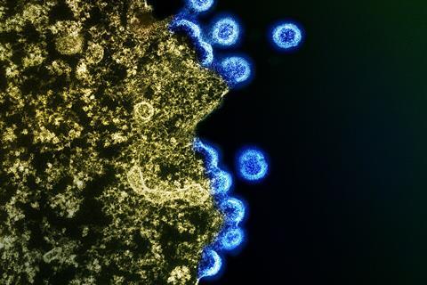 HIV_Virus_Particles_-_53567924670 (1)