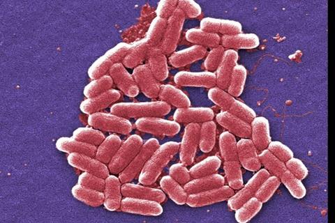 Escherichia_coli_electron_microscopy